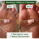 Resultados antes y después en 14 días