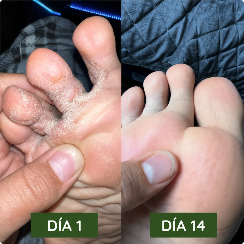 Resultado antes y despues — Sofía M.